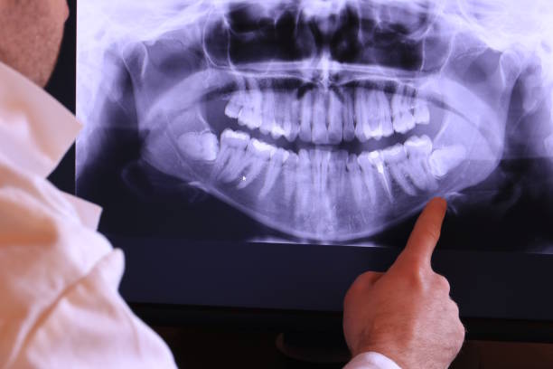 Best Emergency Dental Services for Seniors in Huntgburg, IN