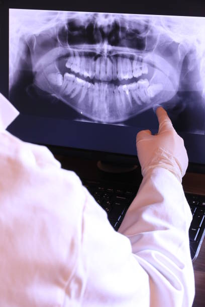 Best Mobile Emergency Dentist in Huntgburg, IN